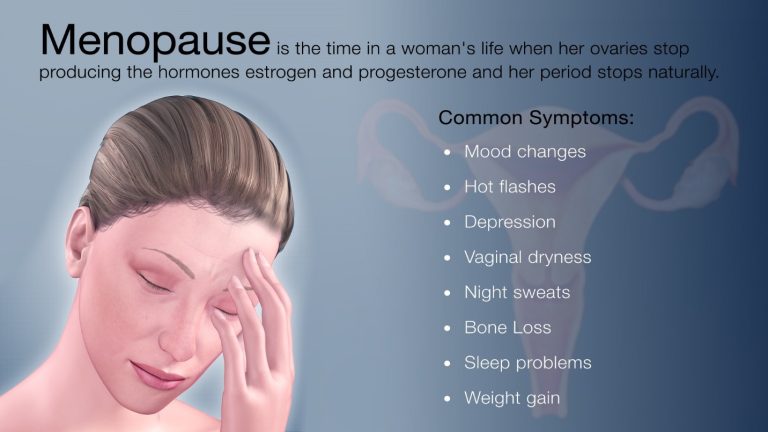 Common Menopause Symptoms